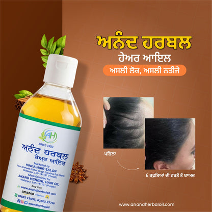Anand Herbal Hair Oil + Anti-Dandruff Shampoo Combo (1+1 Pack)