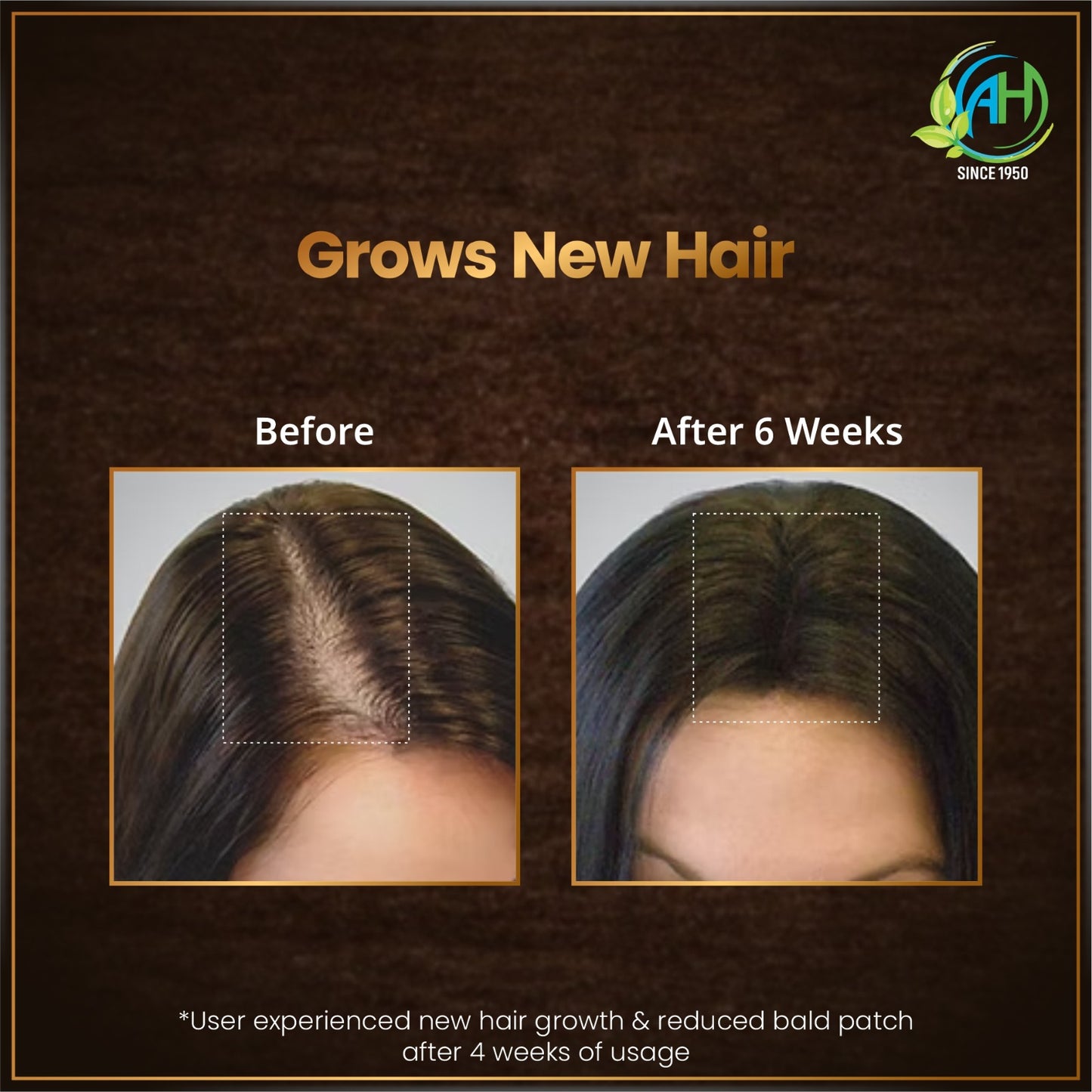 ANAND Herbal Hair Oil Combo – Complete Herbal Care for Healthy Looking Hair