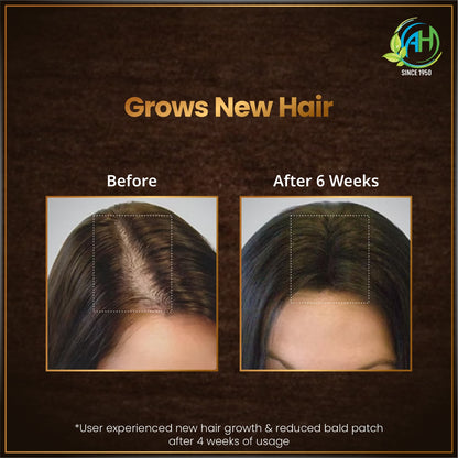ANAND Herbal Hair Oil Combo – Complete Herbal Care for Healthy Looking Hair